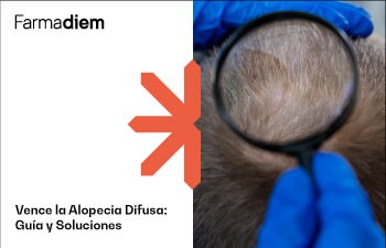 ¿Qué es la alopecia difusa y cómo tratarla?